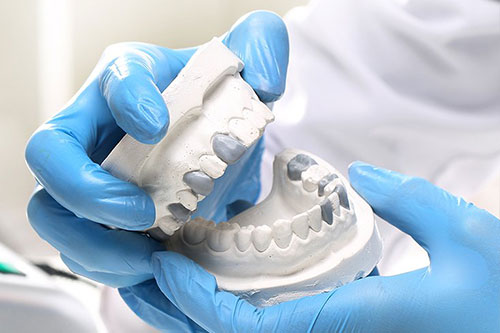 Restorative Dental Services