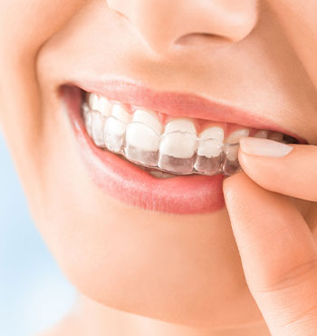 Orthodontic Treatment For Bad Bites