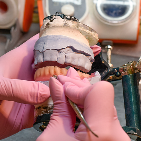 Partial Denture Treatment